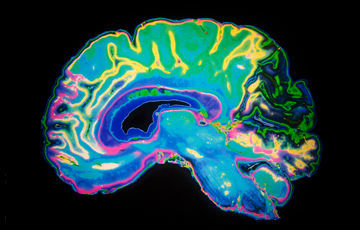 Cross section of a colorful brain